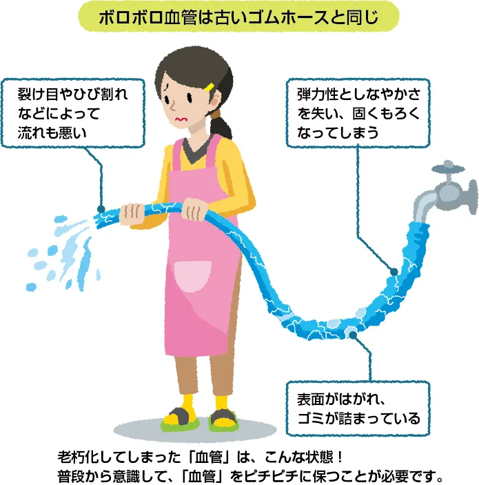 ボロボロ血管は古いゴムホースと同じ