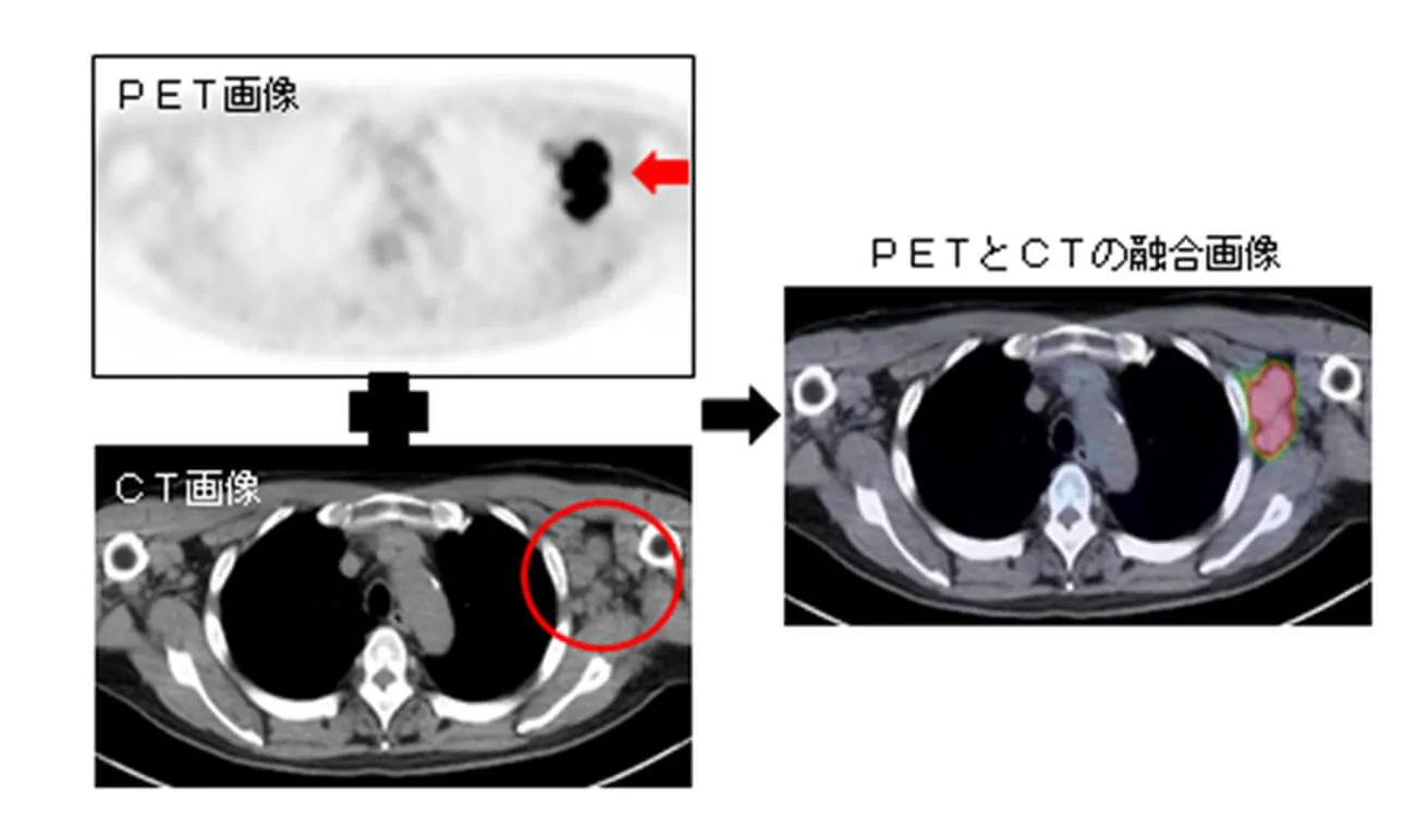 実践! PET-CT診断