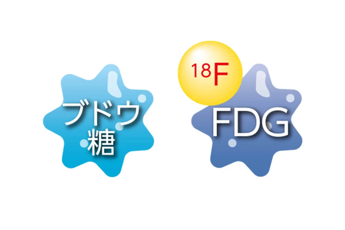 ブドウ糖　FDG