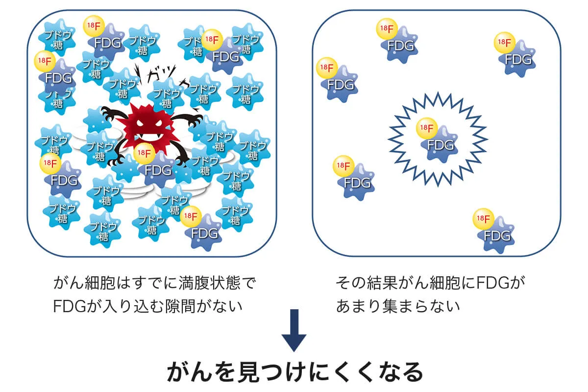 がんを見つけにくくなる