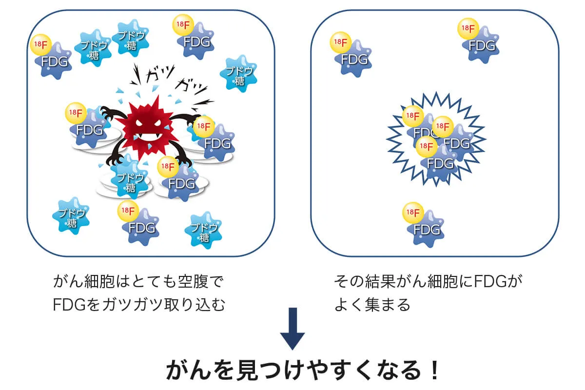 がんを見つけやすくなる！