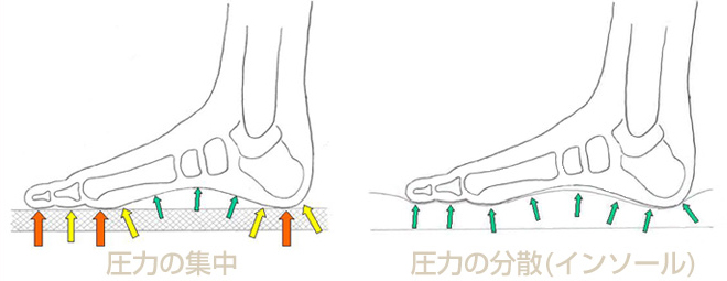 フットウェアのしくみ