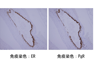 免疫染色