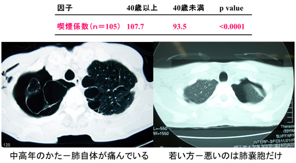 手術になった気胸