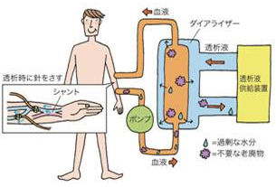 ケアの内容