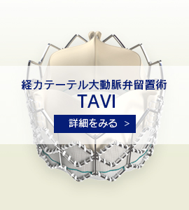 経カテーテル大動脈弁留置術 TAVI