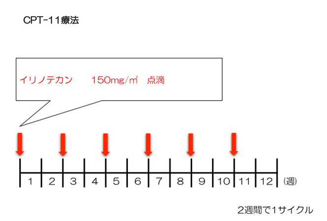 CPT-11療法