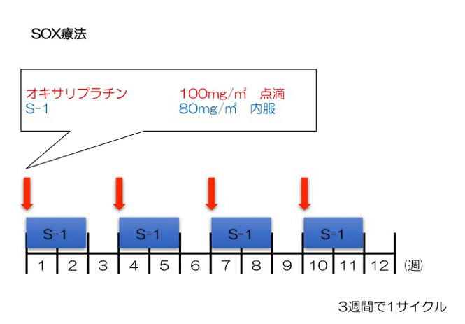 SOX療法