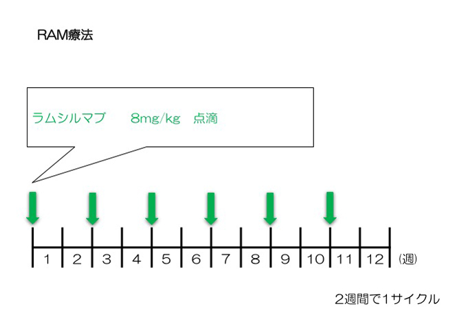 RAM療法