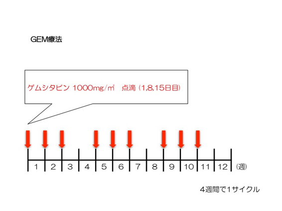 GEM療法