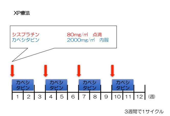 XP療法