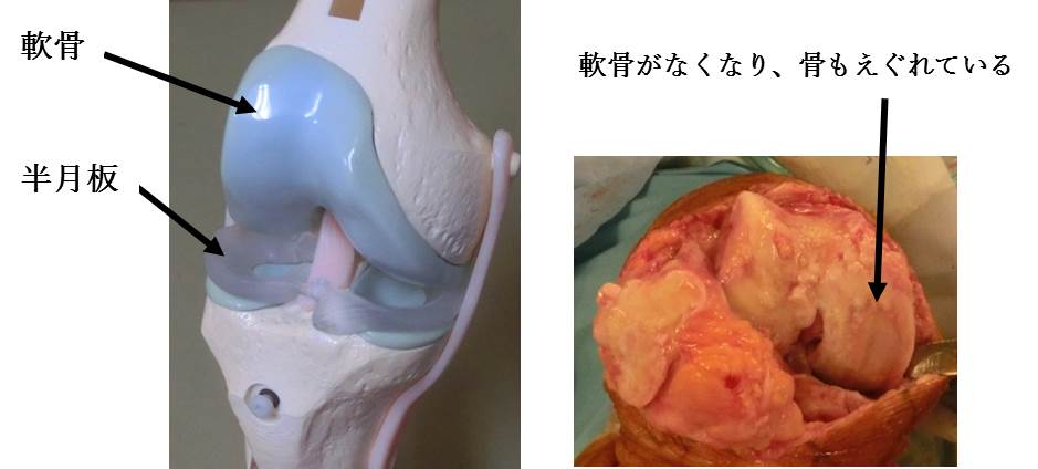 公式】人工膝関節センター｜湘南鎌倉総合病院