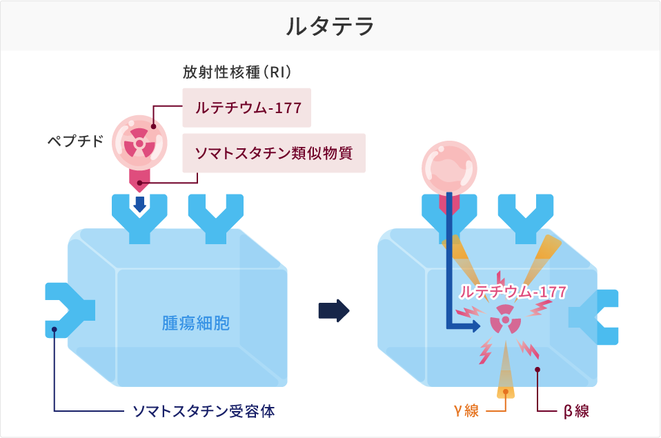 ルタテラ